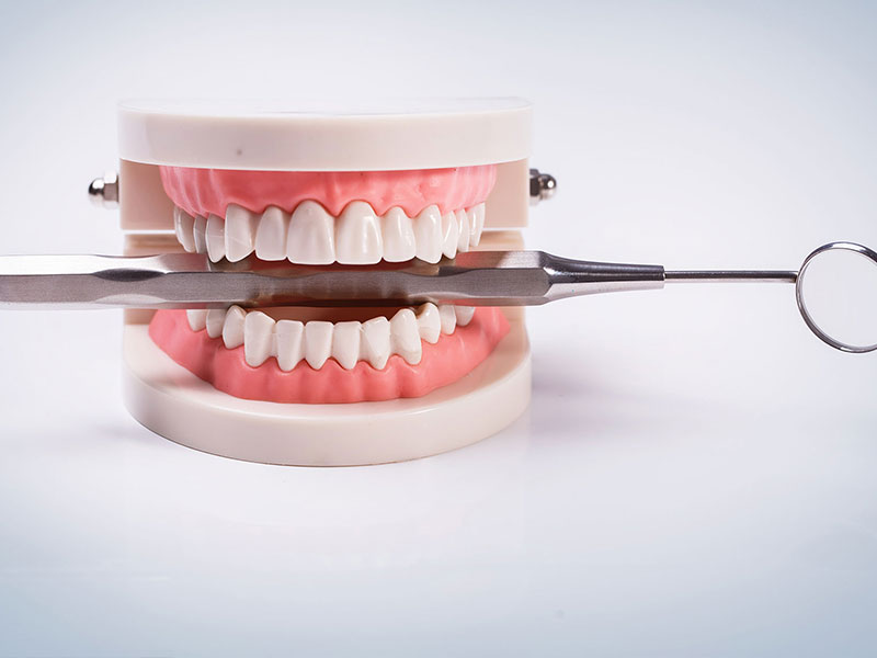Diş Protezi Ne Kadar Sürede Yapılır?